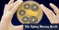 Medical Research Future Fund: Advocates urge increased disbursements amid US research cuts