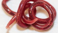 Man Who Couldn't Urinate Discovered He Was Infected With One Of The Largest Parasites Possible