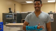 NMCSD Enhances Orthopedic Care with 3-D Printed Waterproof Casts | Soldier Systems Daily Soldier Systems Daily