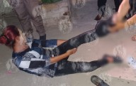 Balea a su vecino tras riña en fiesta
