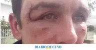 Arranca el juicio a 3 policías por golpear a un hombre ebrio que paró para no chocar