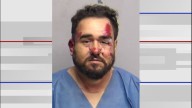 Motorcyclist arrested on intoxication assault charge following...