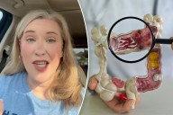 I had stage 4 colon cancer at 32 — these are the symptoms I missed