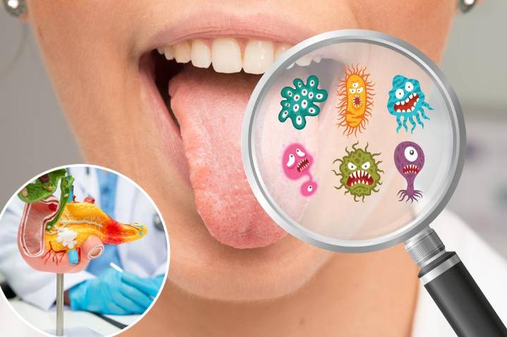 Your dirty mouth may up your risk of pancreatic cancer: study