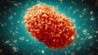 Mpox case reported in Riverside County resident who traveled overseas