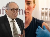 Sarampión en México: ¿qué hacer si alguien cercano se contagia?