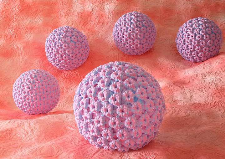 Circulating Tumor HPV DNA Can ID HPV+OPSCC Years Before Diagnosis