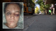 3rd teen arrested in Renton hate crime assault