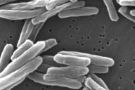 Health officials identify tuberculosis case at Riverside County high school