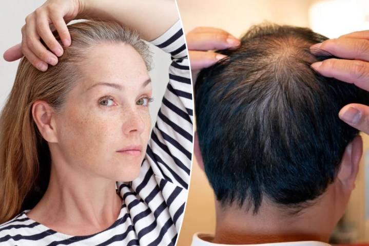 These 2 drinks things can make you go gray and bald
