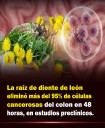 DIENTE DE LEÓN POSIBLE CURA CONTRA EL CÁNCER