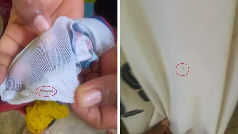 Loreto: padres denuncian presencia de gusanos en el lago turístico de Quistococha, donde se bañaban sus hijos