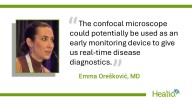 Confocal microscopy identifies corneal nerve fiber irregularities