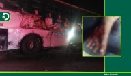 Familia de mujer herida en accidente de tránsito en Barbosa pide traslado urgente; denuncian que empresa de transporte no responde