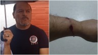 González Catán: balearon en un intento de robo al presidente de una ONG y mató a uno de los asaltantes