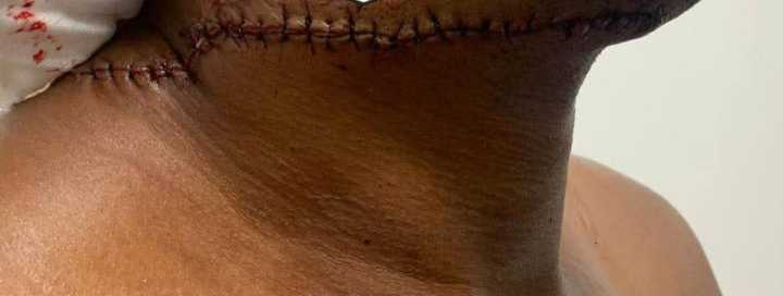 Insólito: árbitro de basketball fue brutalmente apuñalado en pleno partido por un jugador al que le pitaron una falta 
