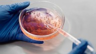 Una mujer, a punto de morir al contraer la bacteria "comecarne": "Me quitaron toda la piel y parte de los músculos"