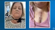 ‘I was in heart failure’: Youngstown teacher cautions women not to ignore heart symptoms