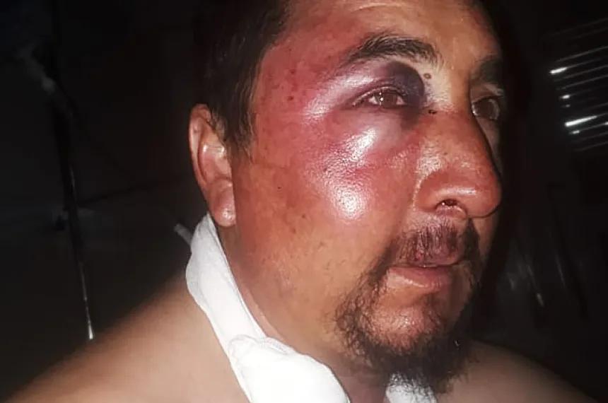 Elevan indemnización por una brutal agresión en Limay Mahuida