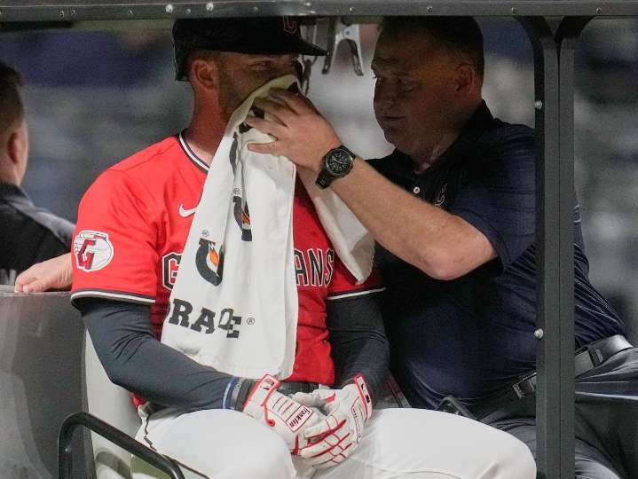 Fry has broken nose, facial fractures after hit by pitch