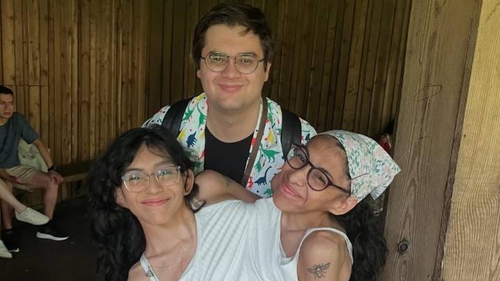 Conjoined Twin Carmen Andrade Reacts to Criticism of Her Sex Life