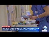 LA County child dies from rare measles-related complication