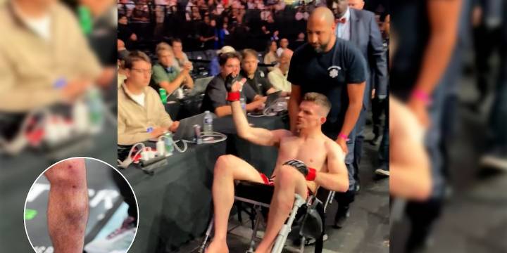 Debutó en la UFC por una baja de último momento, terminó en silla de ruedas y lo apodaron el “peor peleador”: así quedó su pierna