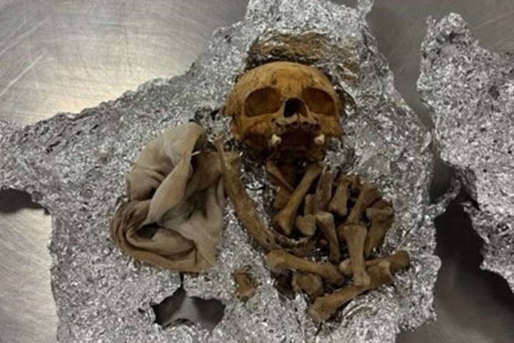 Human Skull and Bones Found in Passenger's Luggage at Florida Airport