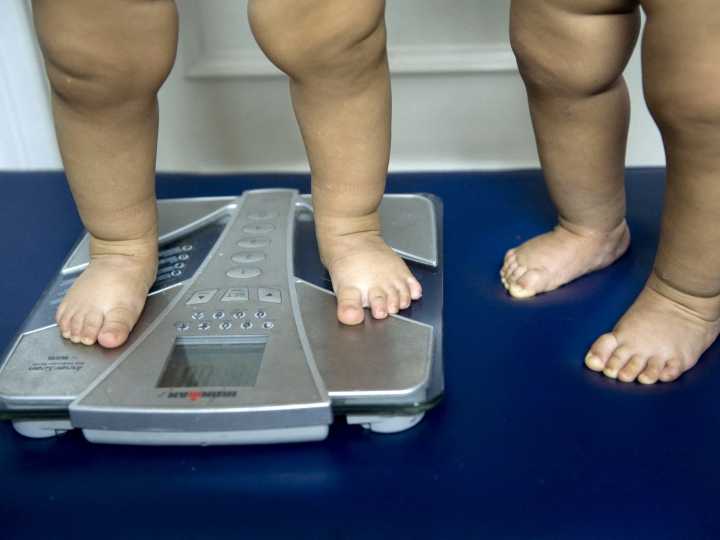Obesity now main form of malnutrition afflicting youth: UNICEF
