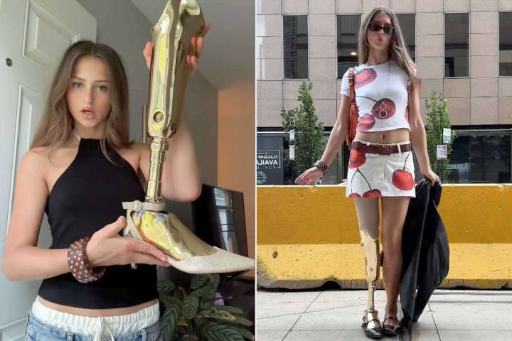 Model Uses Her Prosthetic Leg to Elevate Her Outfits (Exclusive)