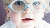 Mi hijo tiene estrabismo: qué hacer y cómo corregirlo a tiempo