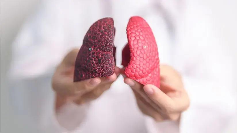 Hablemos de cáncer de pulmón