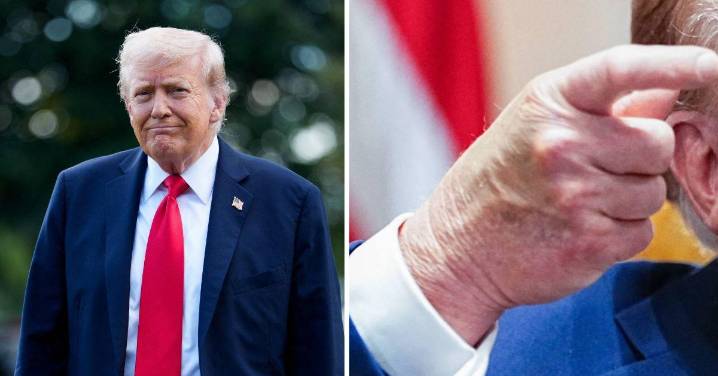 Top Makeup Artists Slams Donald Trump's 'Mashed On' Bruise Concealer