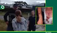 Hombre armado desató terror en La Ceja: disparó a sus vecinos y dejó tres heridos