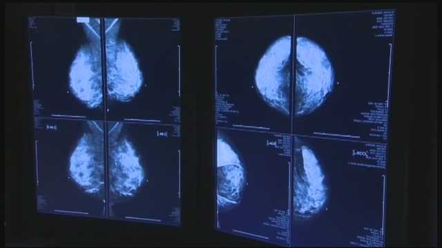 YMCA, Norton Healthcare team up to offer breast cancer screenings to Louisville residents