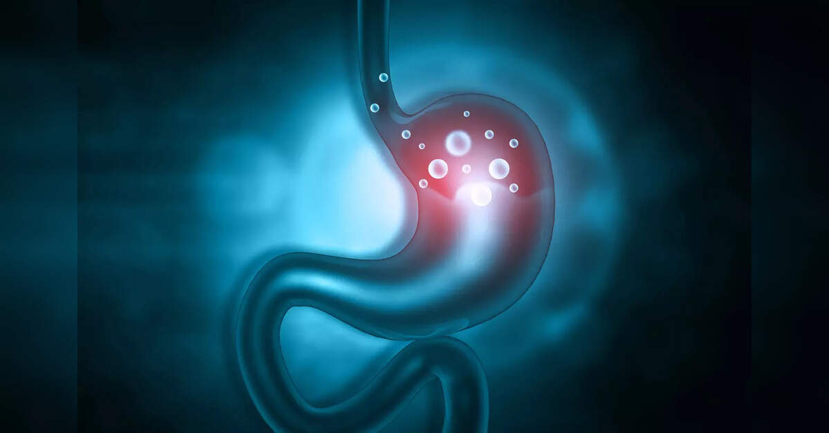 J&J to withdraw acid reflux device from certain markets outside US