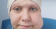 Midlands mum who had scalp ripped off in horror work accident wins seven