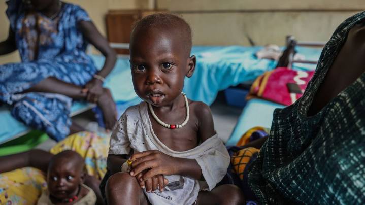 'Children are bound to die': Corruption, aid cuts and violence fuel a hunger crisis in South Sudan