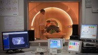 Resonancia magnética de vejiga: menos biopsias y mejor tratamiento