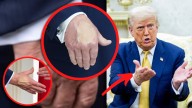 La misteriosa mancha en la mano de Trump