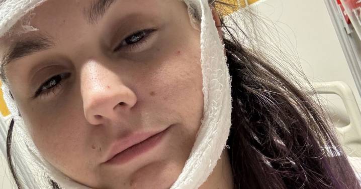 'I wet myself, smashed my face and wanted to die after taking laughing gas'