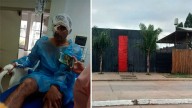 Un joven denunció haber perdido un ojo por una salvaje agresión policial a la salida de un boliche
