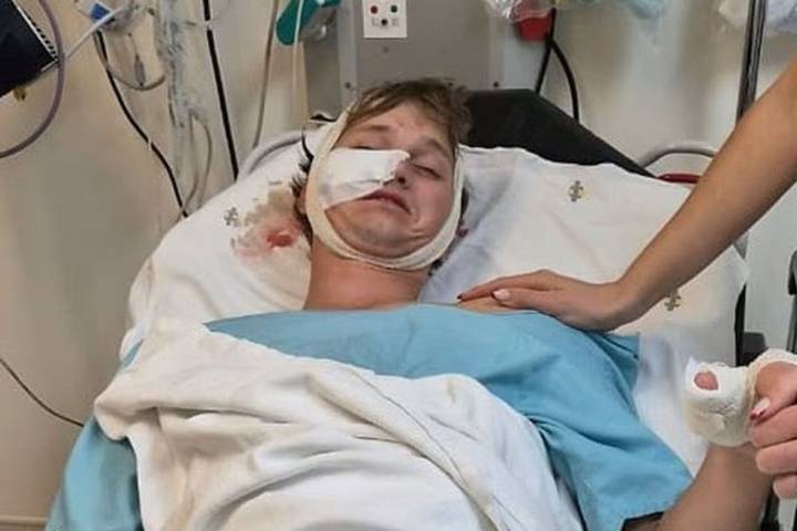 Man Attacked by Hyenas, Dad Found Him in 'Pool of Blood' (Exclusive)
