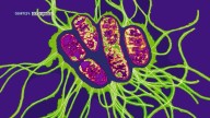 Typhoid detected in Capital Region school