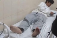 Piura: Familia de joven accidentado solicita apoyo económico para costear operaciones urgentes