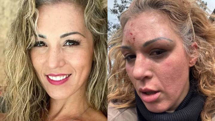 Exchica Mekano reaparece tras brutal agresión de su pareja: “Hoy celebro el milagro de estar viva”