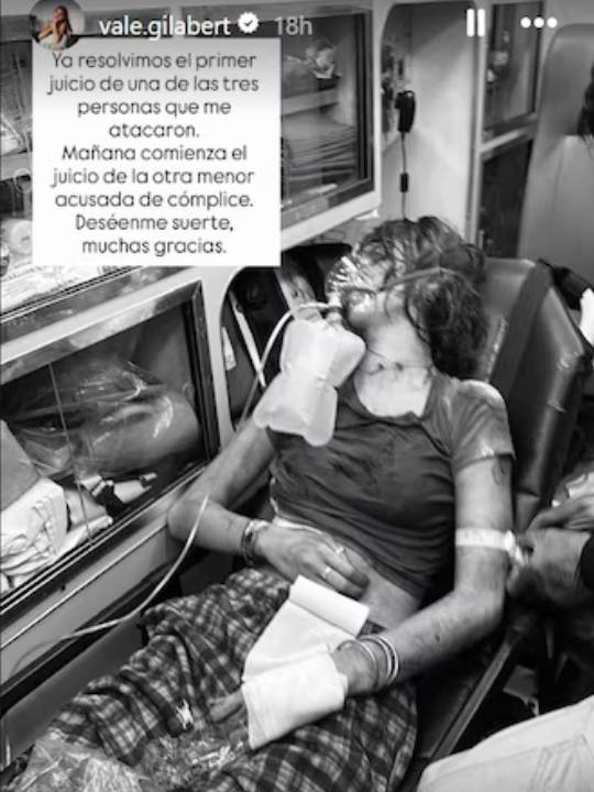 Valentina Gilabert publica impactante foto del día que Marianne la atacó y todo internet está en shock