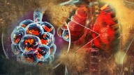 Tuberculosis en Nuevo Laredo: ¿cómo se transmite y cuáles son los síntomas?