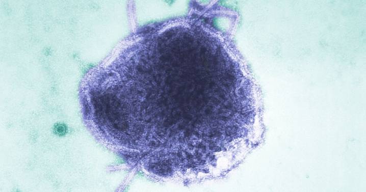 Los Angeles child dies from rare measles complication years after recovery