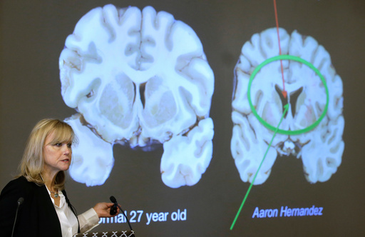 Here's what to know about CTE, the brain disease the NYC shooter blamed for his mental health issues